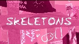 Vorschaubild des Videos Skeletons